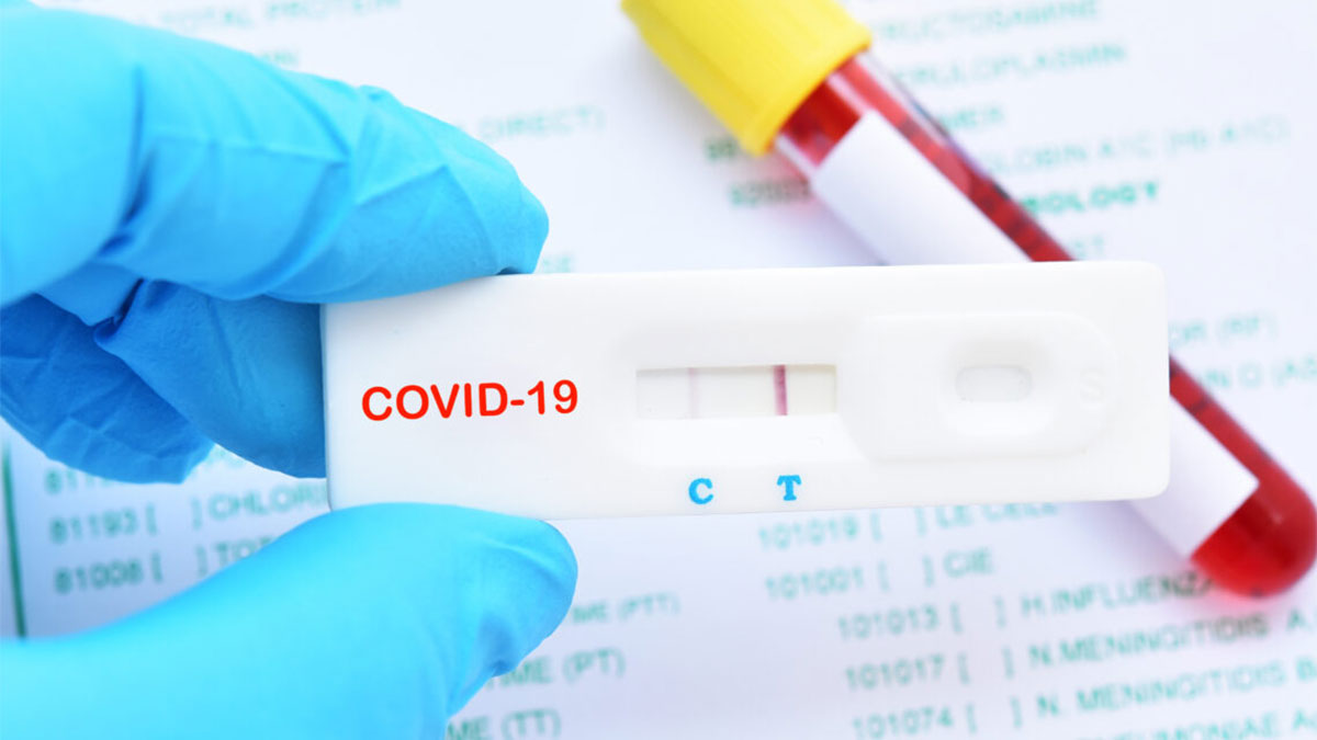COVID - Testes vencidos ou prestes a vencer serão reexaminados por Programa  de Avaliação de entidades do setor de diagnóstico - ALADDiV